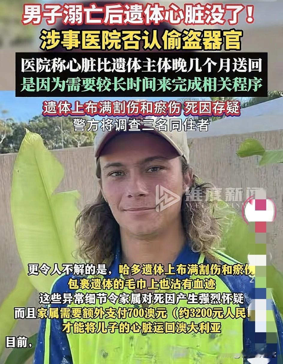 不出意外
​意外还是发生了
​谁能想到23岁澳大利亚男子拜伦哈多（Byron H
