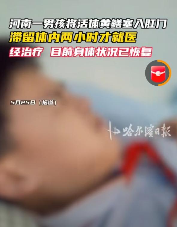 猎奇冲动险些酿成致命重伤！河南商丘一名14岁男孩私自将活黄鳝塞入体内。
 
黄鳝