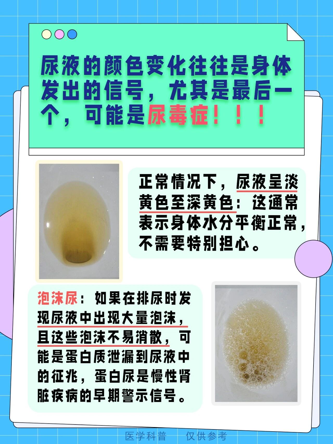 肾病尿液颜色的变化，希望大家都是第一个！尿液颜色的变化常常是身体健康状...