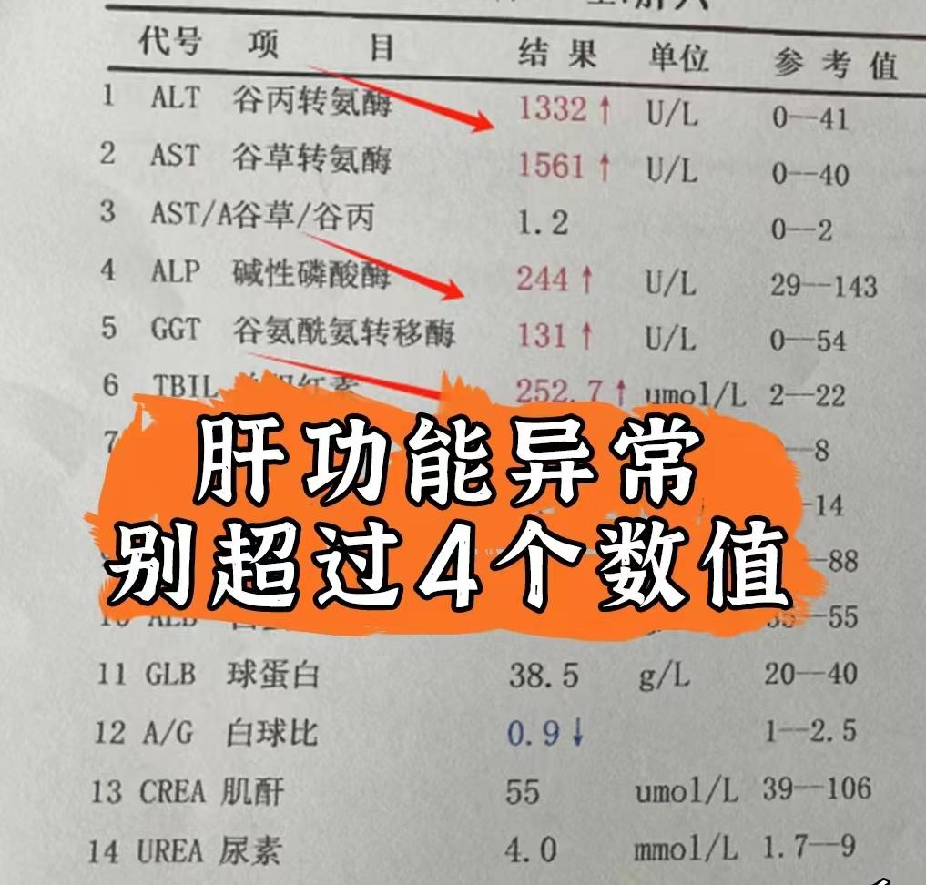 肝功能异常只要不超过这4个数值不是大问题！ 肝功能是反映肝损伤的重要指...