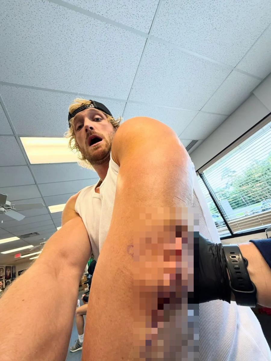 知名网红、WWE 双打冠军 Logan Paul 近日在社交媒体上甩出一组最新自