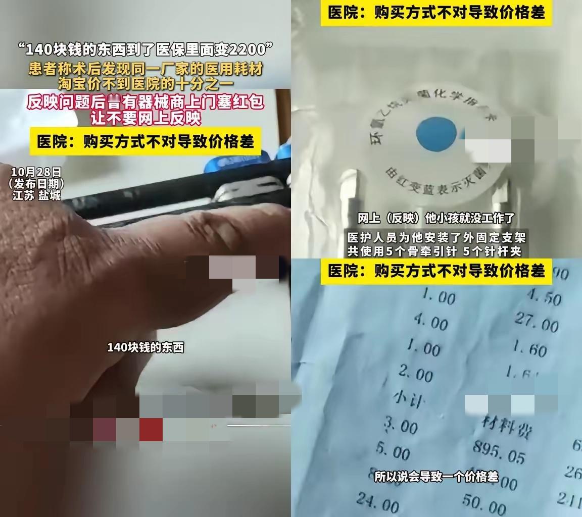 江苏盐城黄先生的遭遇不是个例，淘宝同厂同型号的骨折耗材才140，医院医保价直接飙