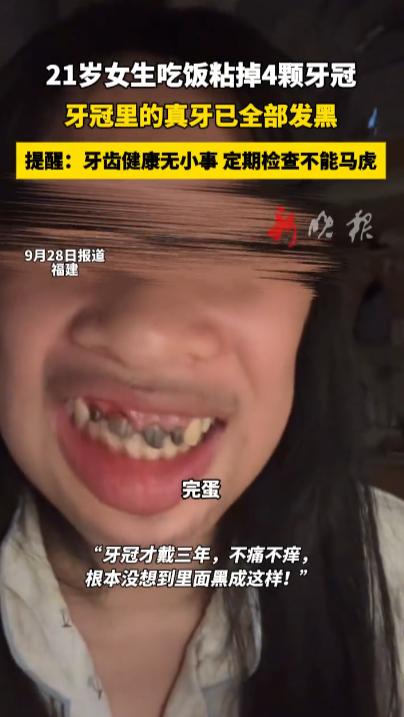 “离了个大谱！”9月28日，福建，一21岁女生吃饭时不小心把自己的四颗牙冠粘掉了