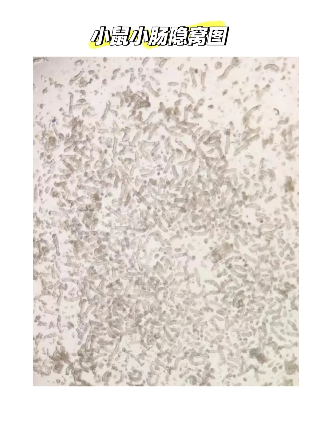 小鼠小肠结肠隐窝明场对比图
