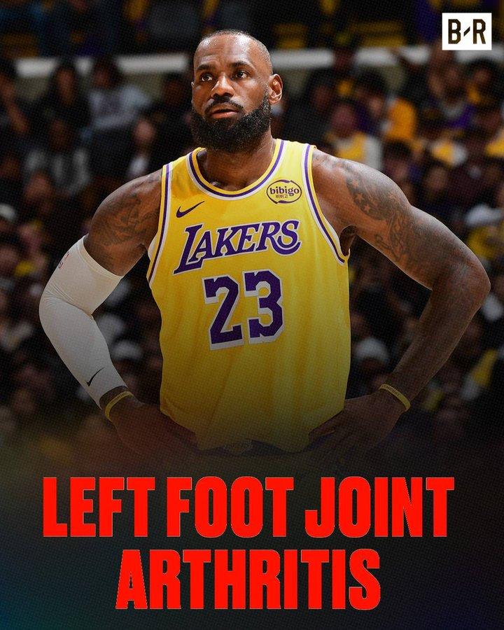 詹姆斯能否出战凯尔特人的比赛成疑。湖人队宣布说，詹姆斯除了右腿坐骨神经痛之外，还