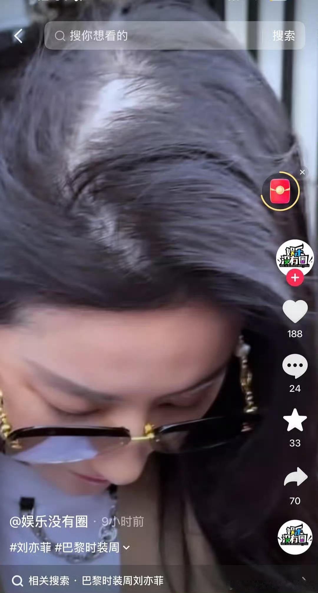 支持美女胖瘦自由！支持美女头秃自由！支持美女恋爱自由！vogue红毯 疲惫