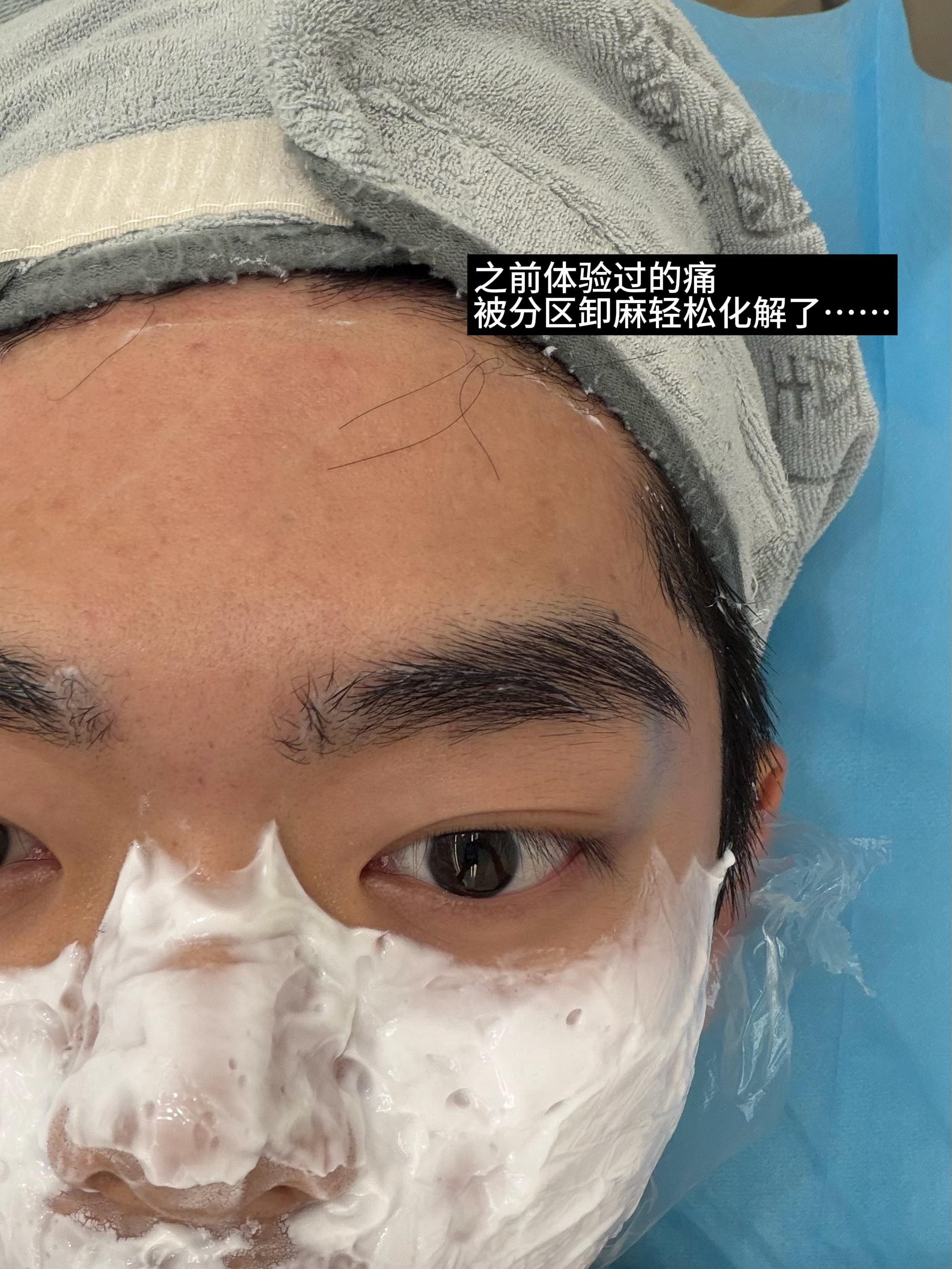 分享下最近这次美妙的美迪迈之旅我自己的情况广东油皮25+ 因为青春期大爆痘过所以