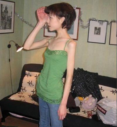 河南一90后女子为减肥辟谷，半个月不吃饭、只喝水，一个月瘦了40斤，代价是什么？