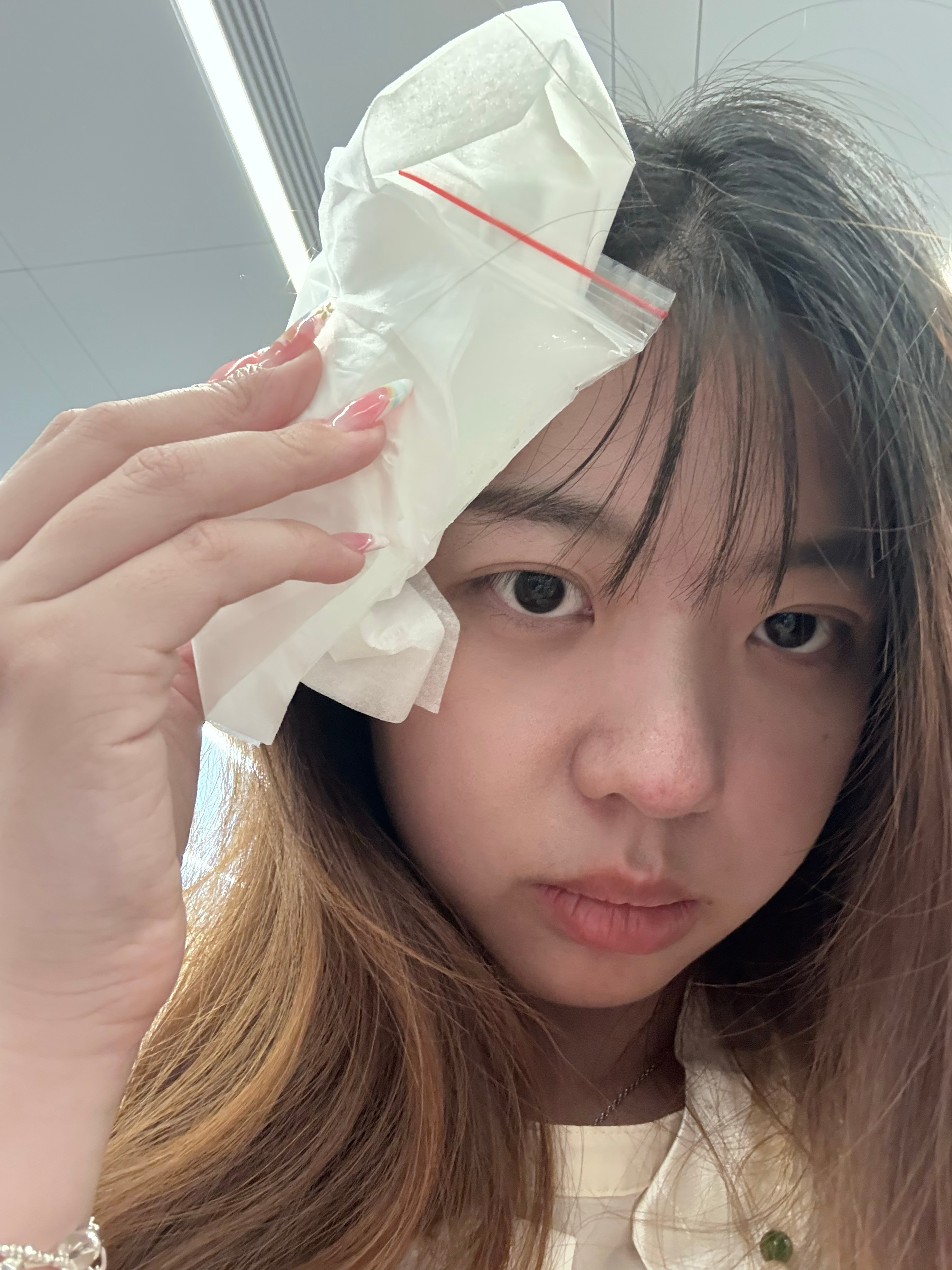 边走路边看会议邮件哐当咋在门框上，直接一个大包平地起高楼，我的苹果肌都未如此丰盈
