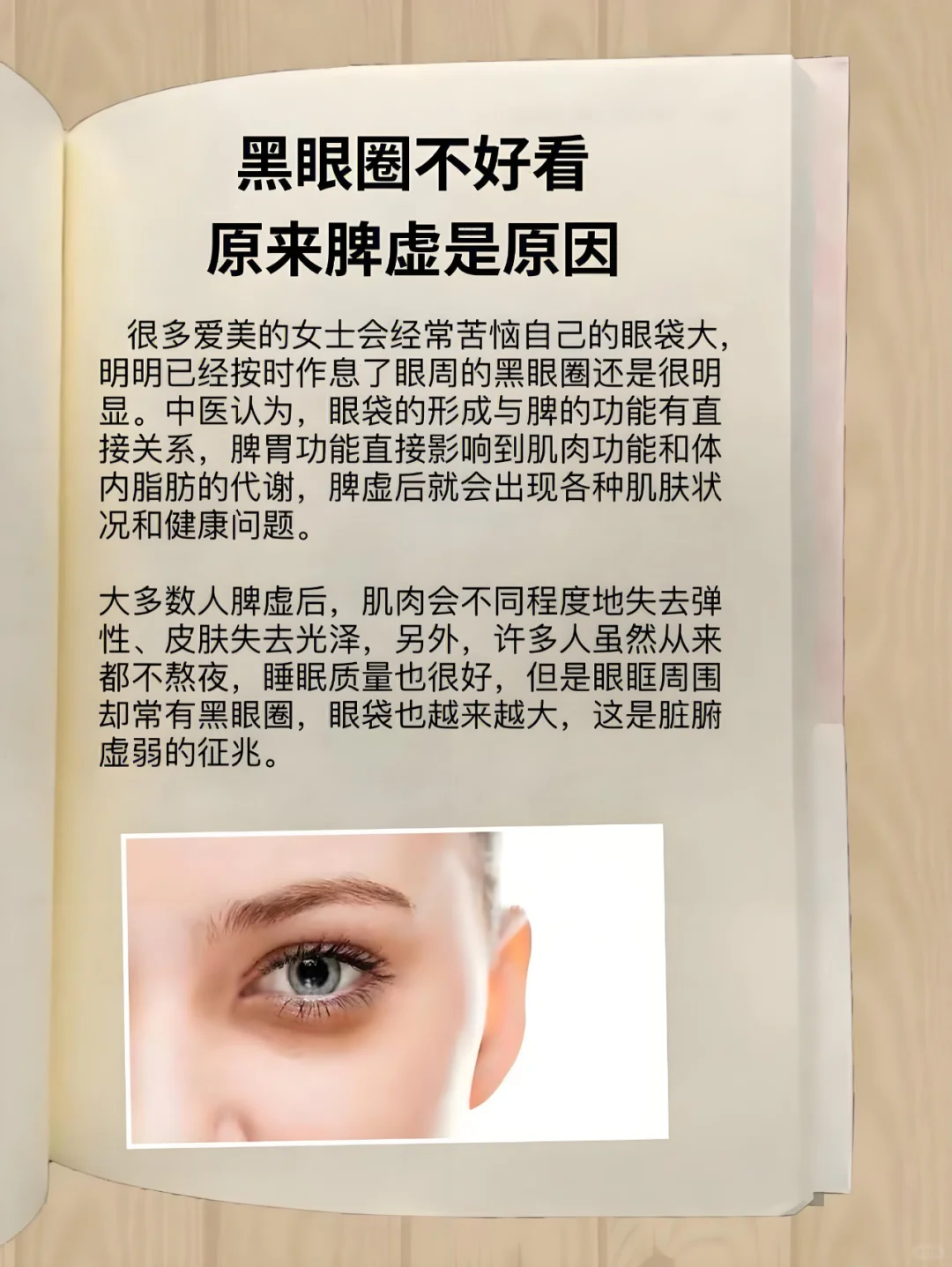 黑眼圈不好看，原来是脾虚的原因！