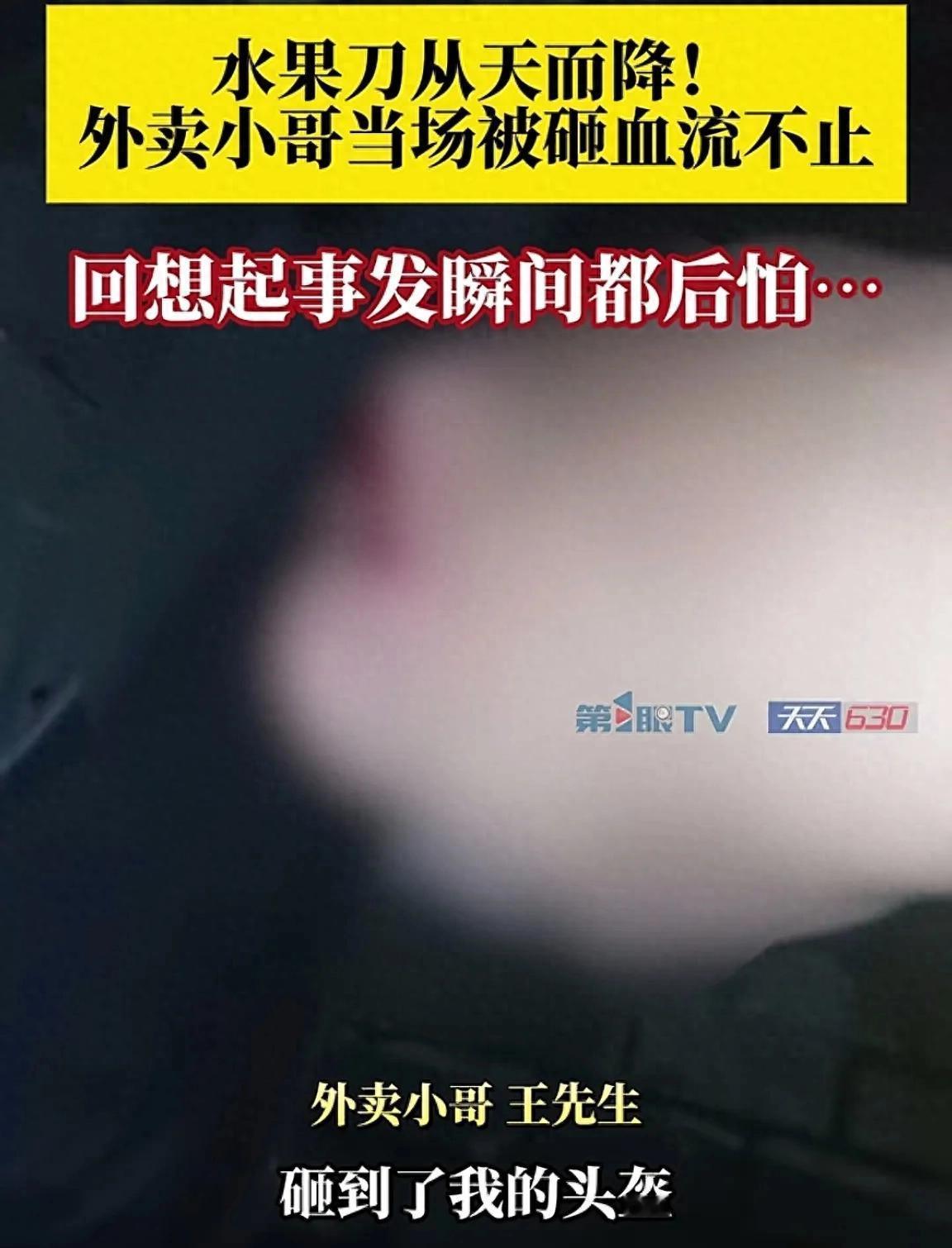 重庆，一外卖小哥被楼上掉下的刀砸中，当场血流不止。被送往医院后，外卖小哥回想起事