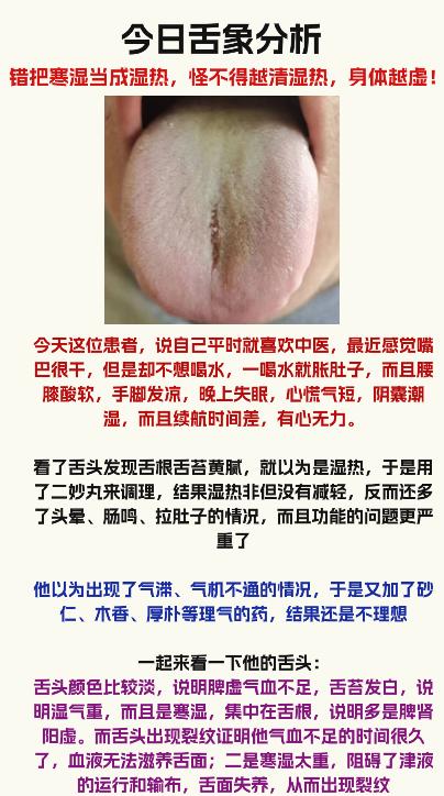 舌面发黄，一定不要直接补，只会让你越来越虚




#中医#