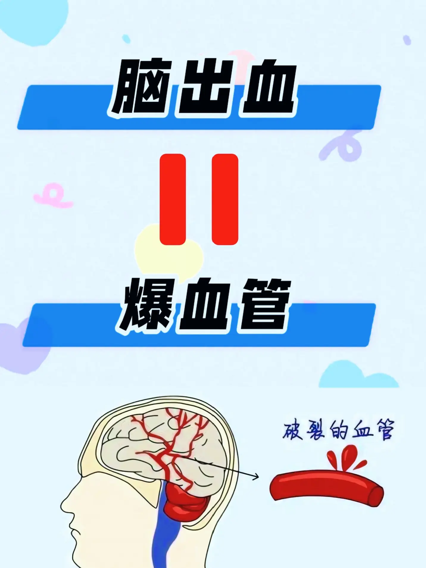 脑梗 脑出血 健康 健康科普在