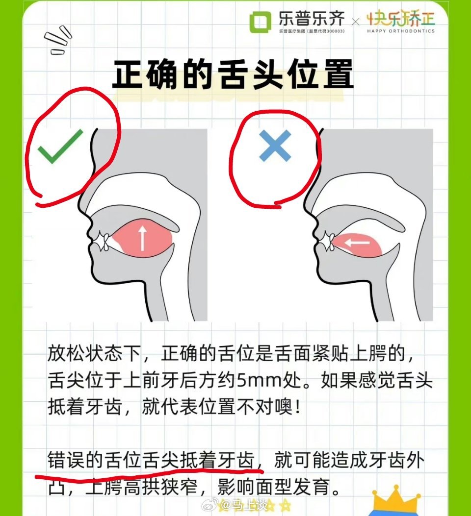 #别再把舌头垫在牙齿中间了# 无语，正确是舌头抵住上颚，错误是舌头抵住牙齿…不知
