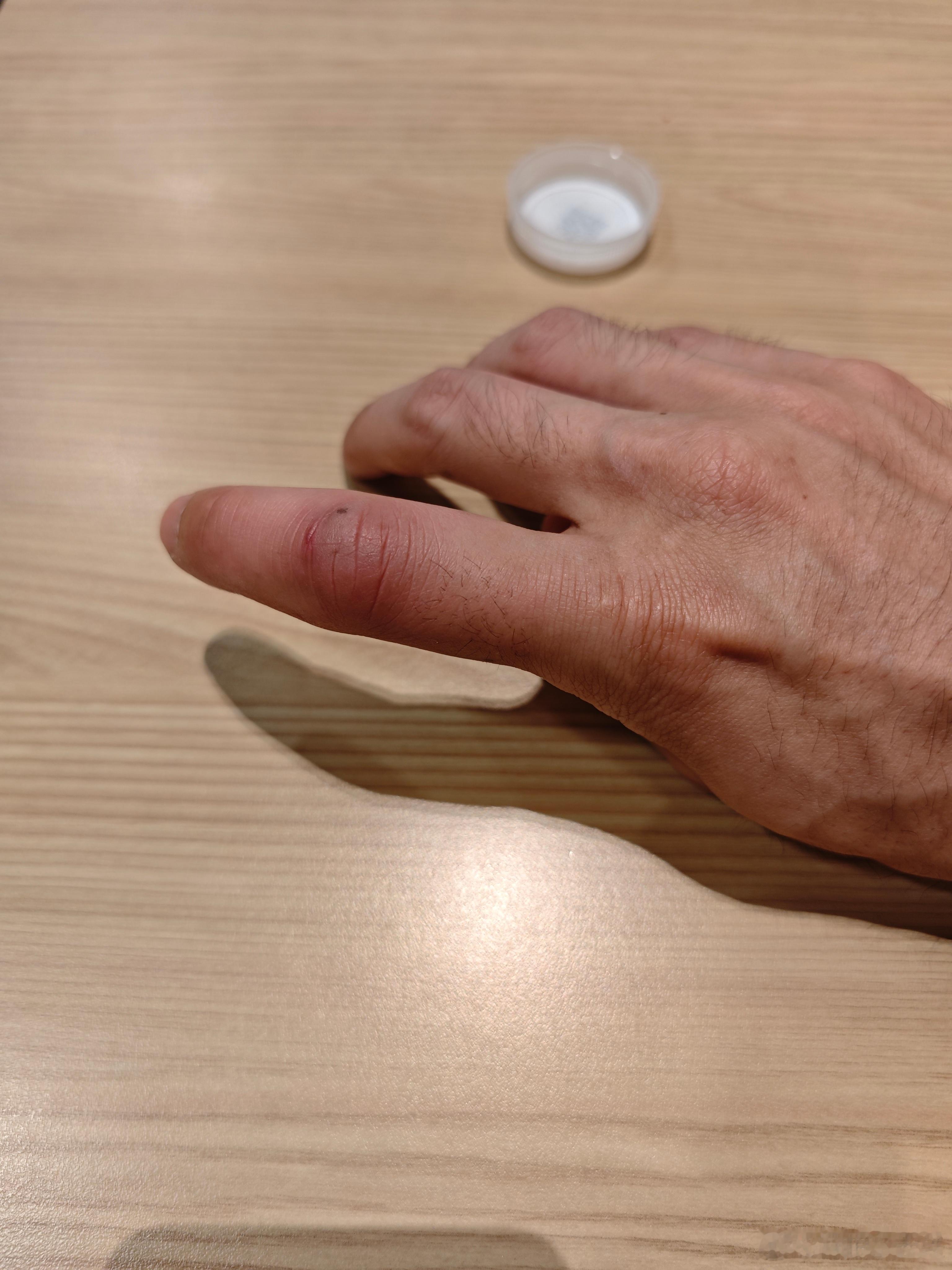 拍摄理想 i8 付出的代价，是获得一根健壮的手指。铁丝日记 ​​​