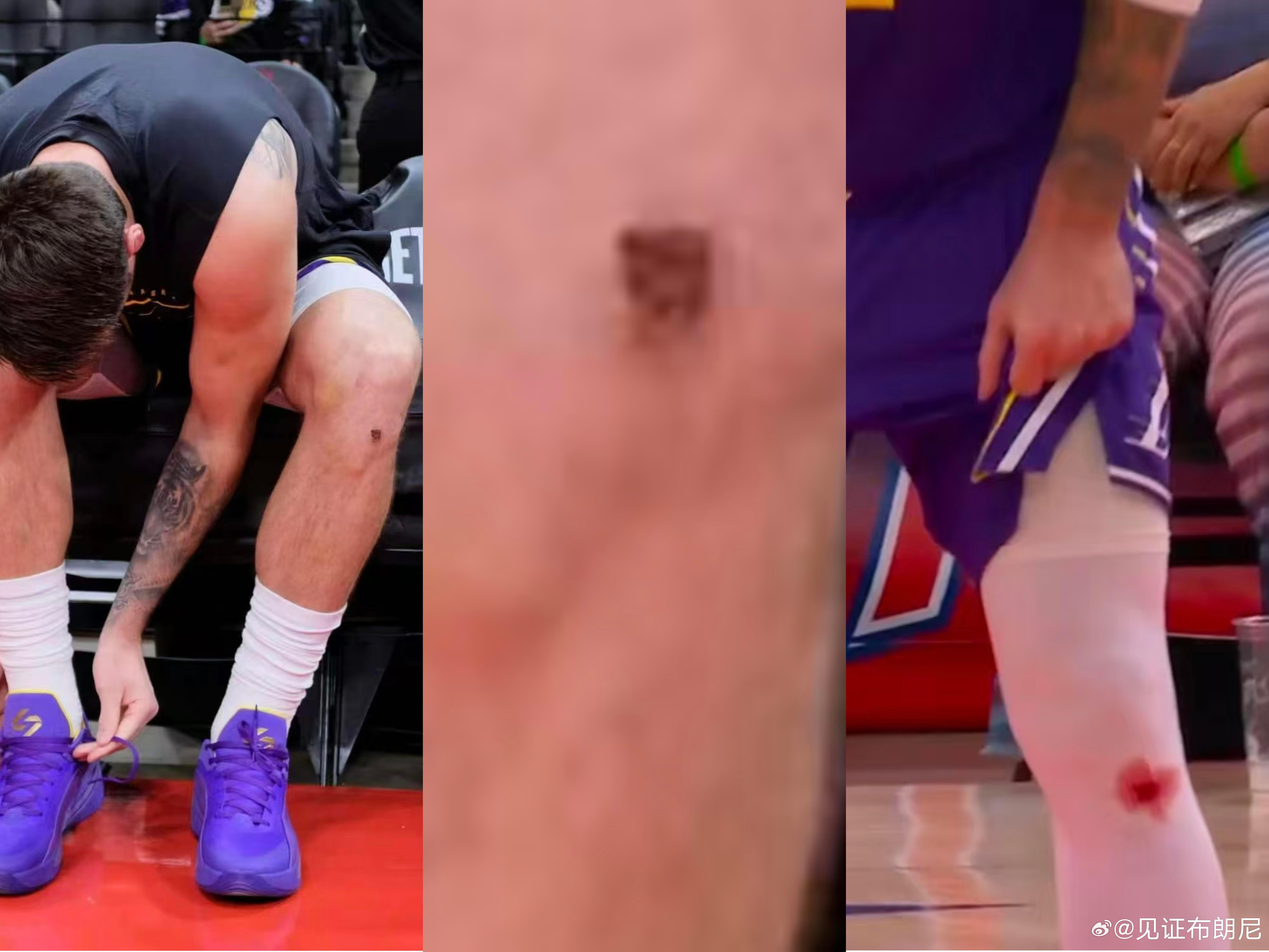 药水？血！分手后的卢卡，是真强啊。湖人vs热火