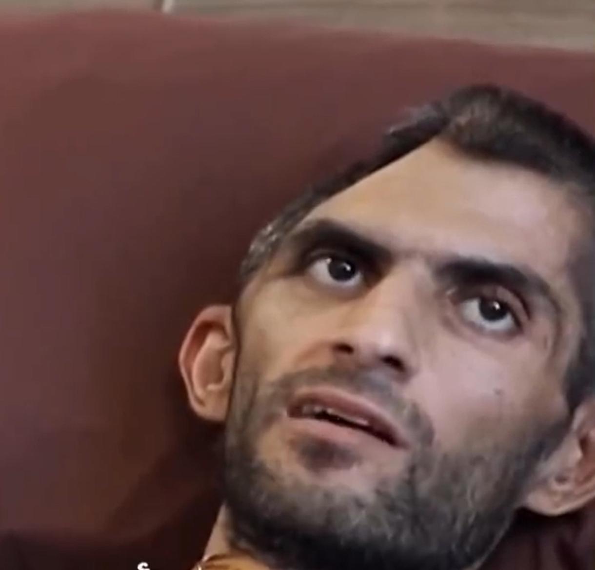 你敢想象，这是同一个人吗？

这是巴勒斯坦的一名记者，被以色列关押之后，出来就变