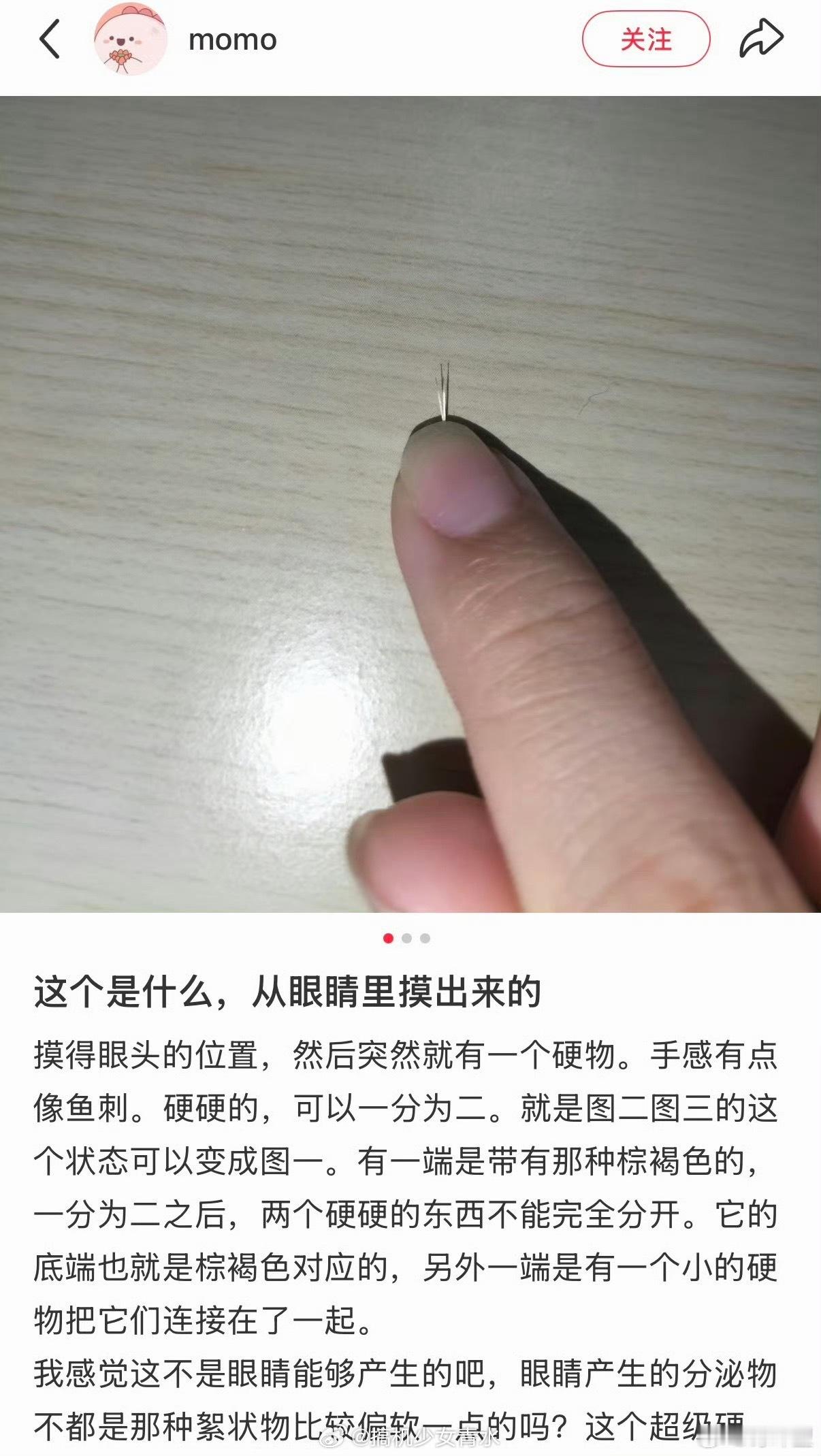 睫毛掉进眼睛里钙化了从小到大不知道进了多少东西最狠的一次，小伙伴在预制板的一头放