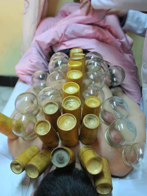 消防救援 

拔罐一时爽，卡脖喊消防！这波操作看完笑不活了
 
要说最近离谱又好