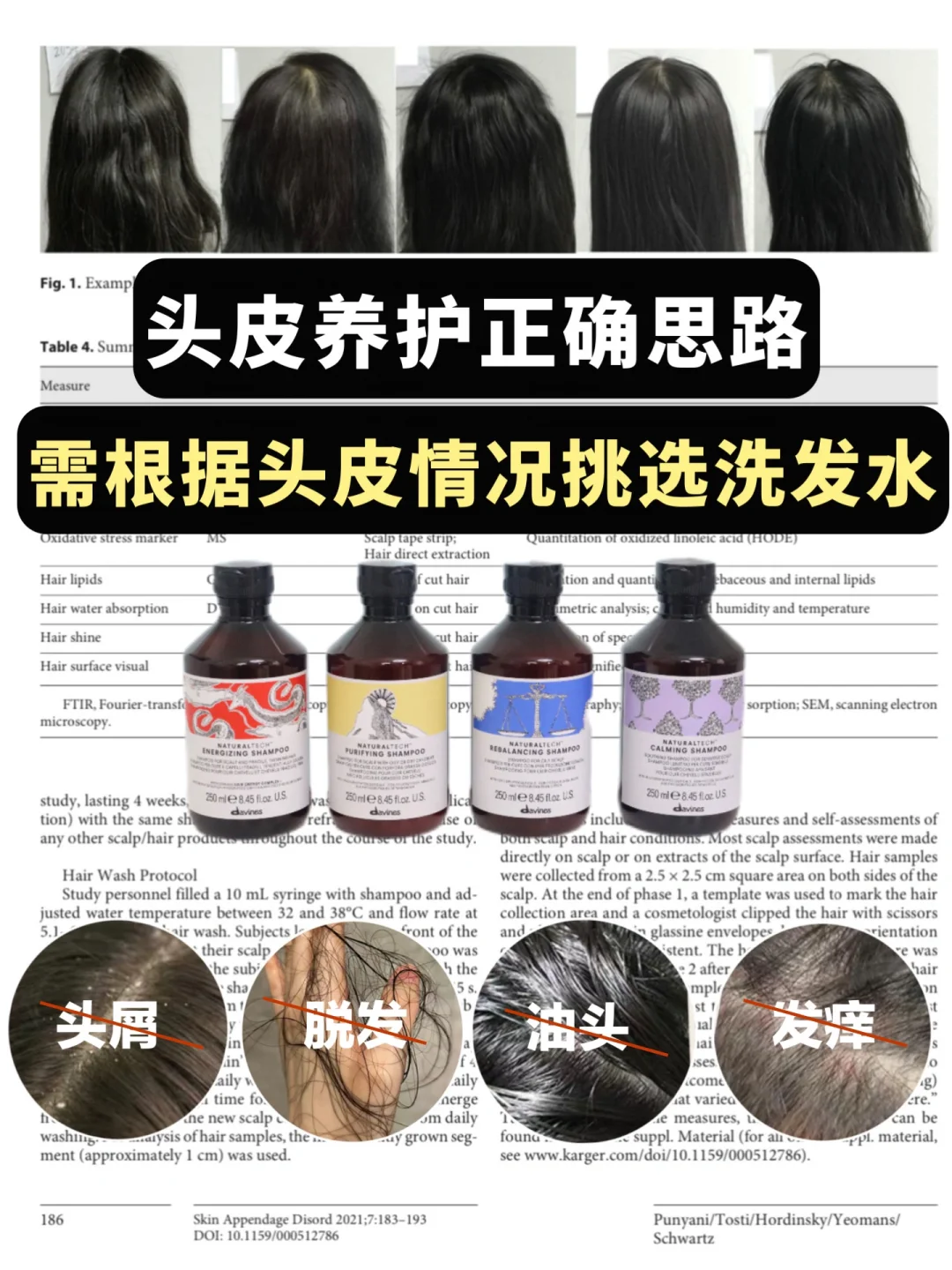 问题发质救星，防d发控油蓬松修护全都有！