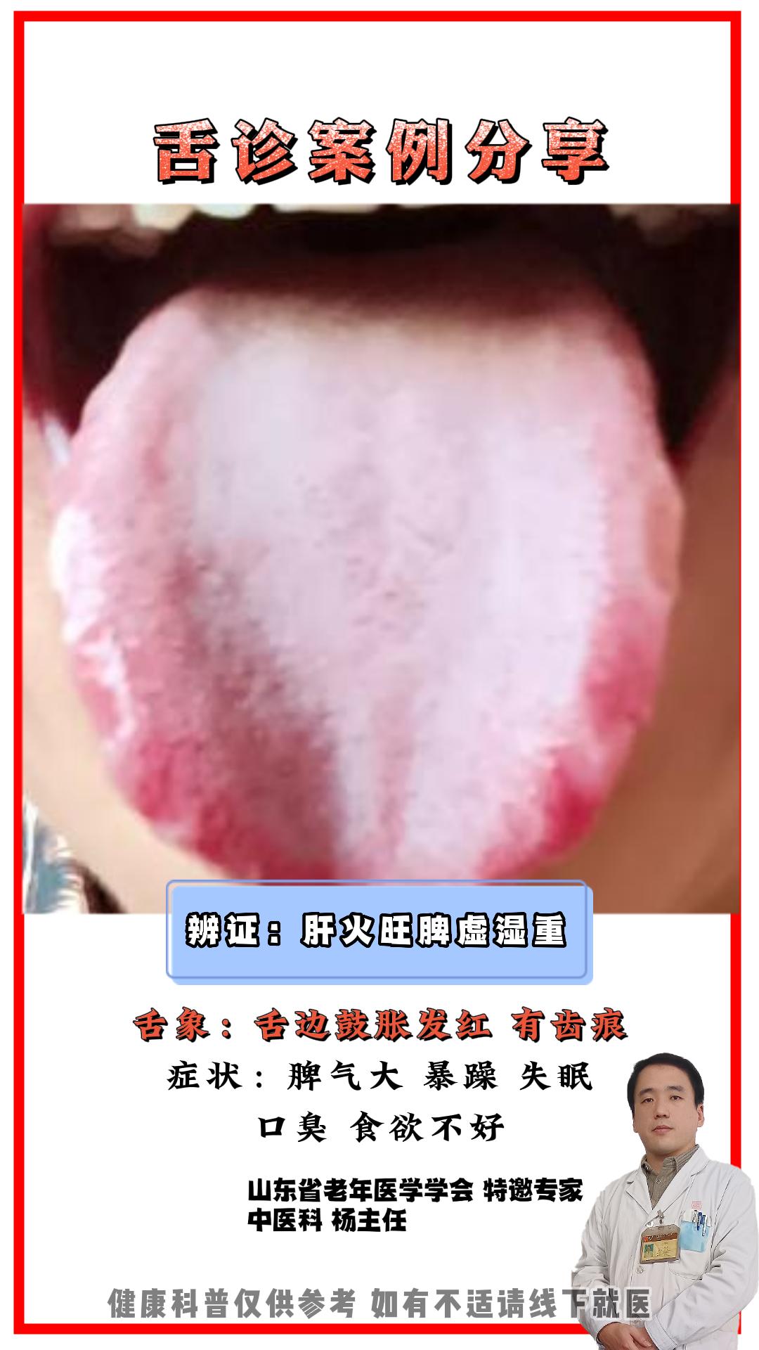 健康科普 舌象 中医科普 涨知识