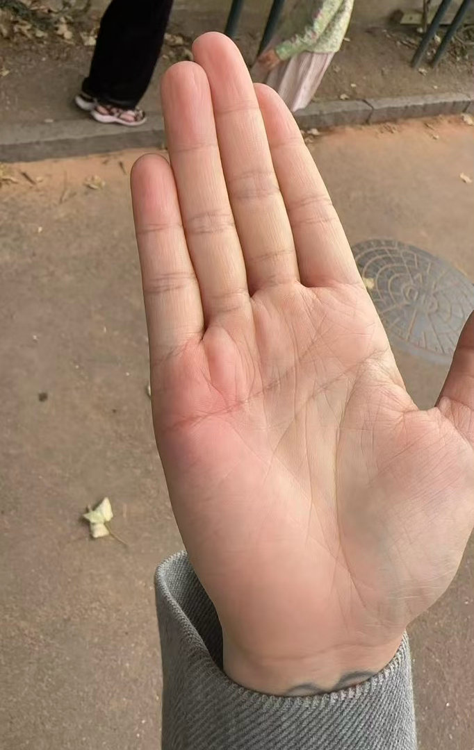 被🐝扎了……蜜蜂小狗竟是我自己