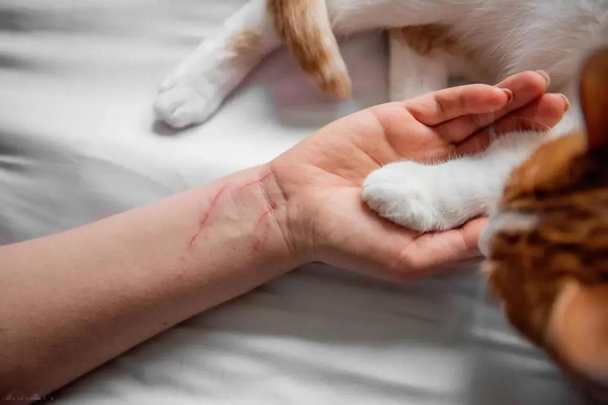 糖尿病、尿毒症和狂犬病是公认最难治愈的三种疾病，它们对人类的生命健康造成了极大的