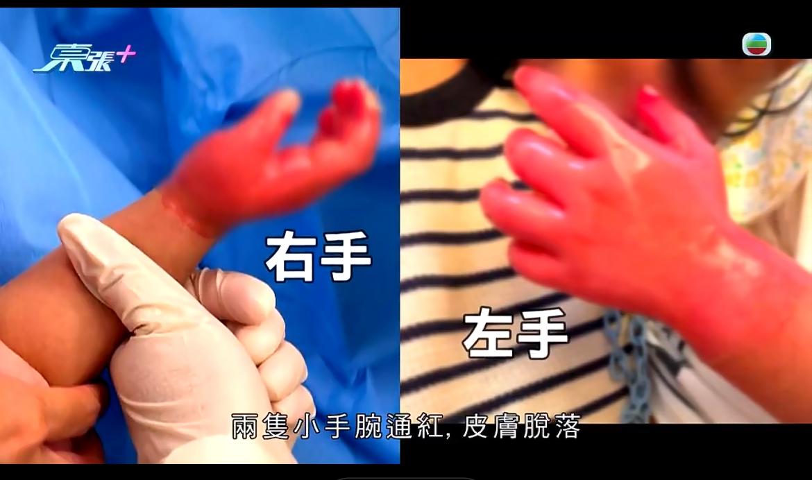 香港元朗发生一起令人愤怒的印尼佣人虐童事件。8月19日下午，香港元朗一名住宅内，