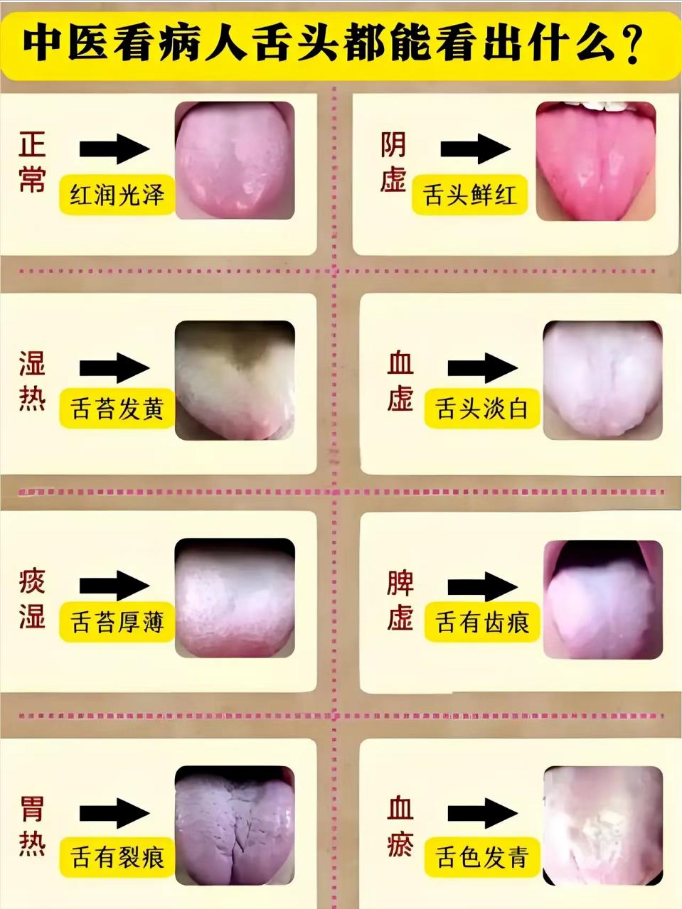 挑战十月份看够999个舌象，已经第9天了，今天不咋忙，继续分析，你发我来看

注