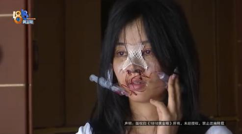 浙江杭州一女子因右手患血管瘤需 20 多万治疗费，去 KTV 面试时被告知每天小