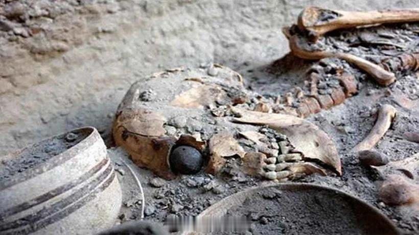 世界上已知最古老的义眼，出土于伊朗约4800年前的“焚城”。它属于一名身高约1.