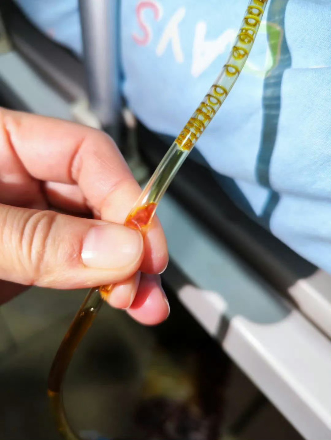 40岁男子吃鱼生后胆管爬满虫子常在河边走，哪能不湿鞋。所以做鱼生、生腌的餐厅也不