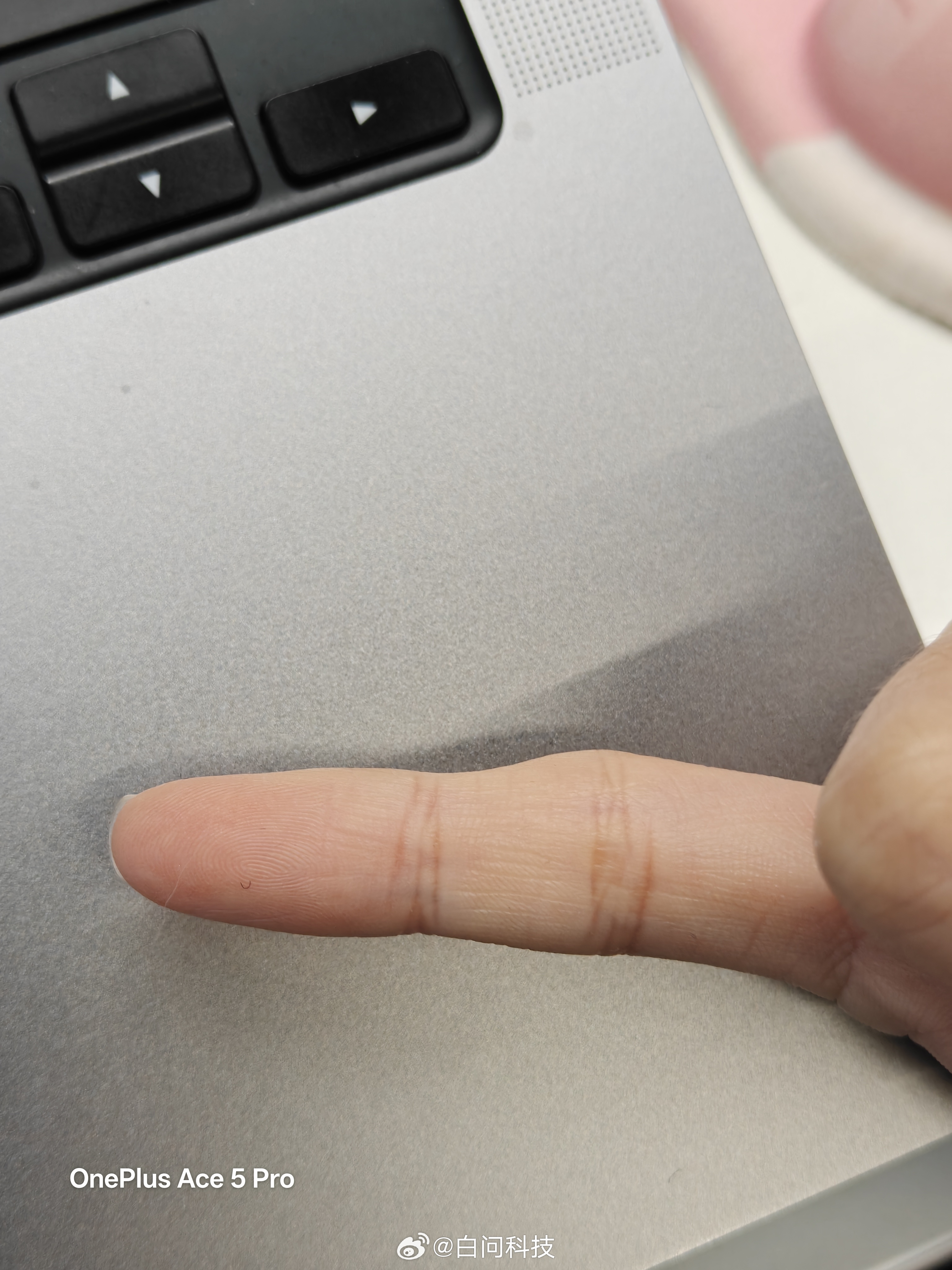 长期用小拇指托手机的后果 还有比我更凹的吗？让我心里好受一点