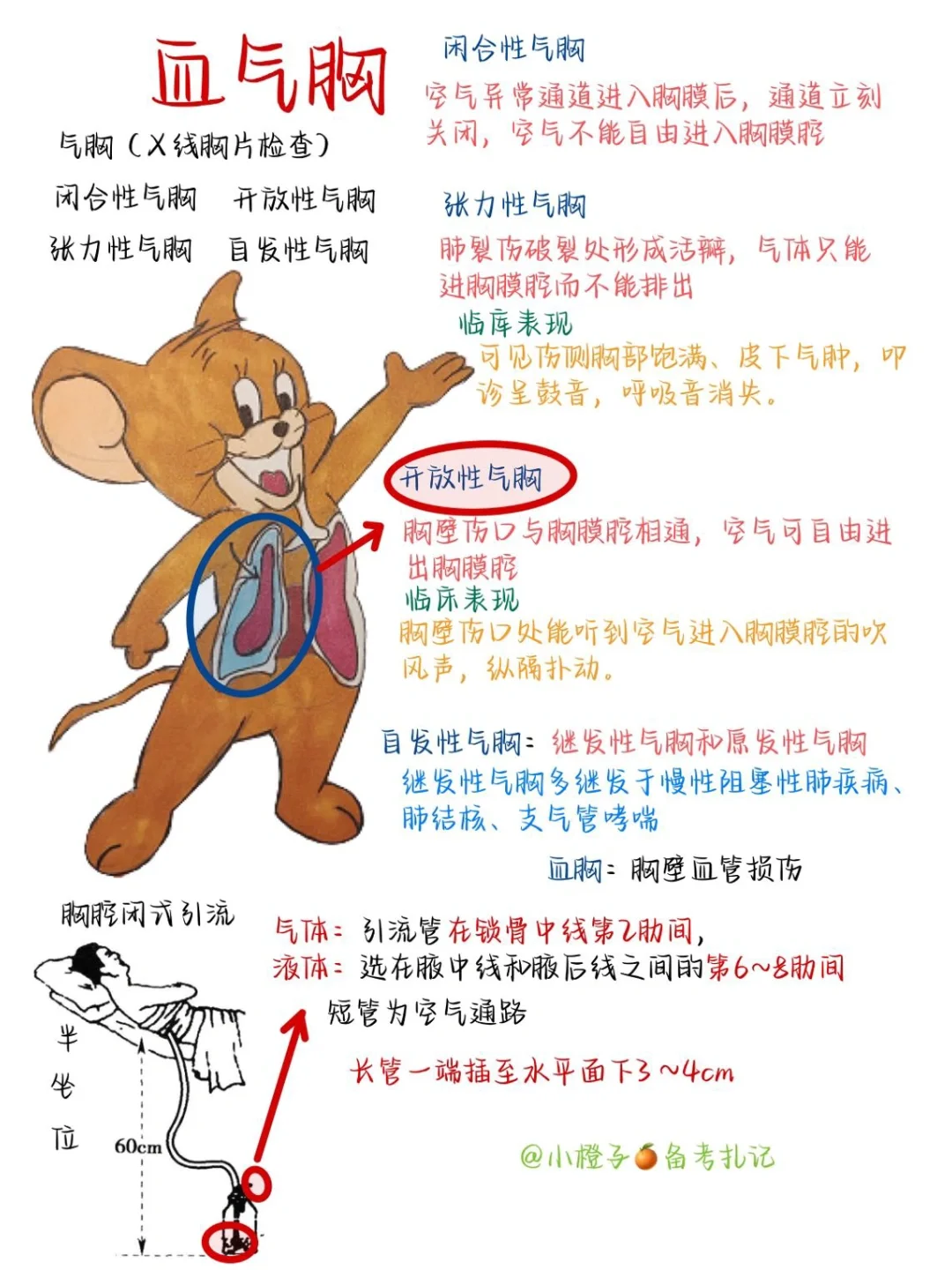 📖护师笔记｜内科护理学｜🩸血气胸