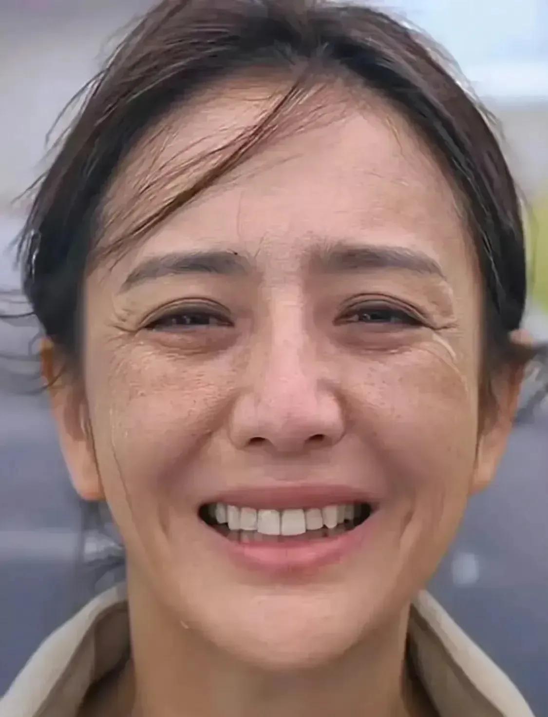天哪！完全不敢相信这是佟亚丽，难道是开了特效吗？和以前优雅漂亮的模样判若两人。