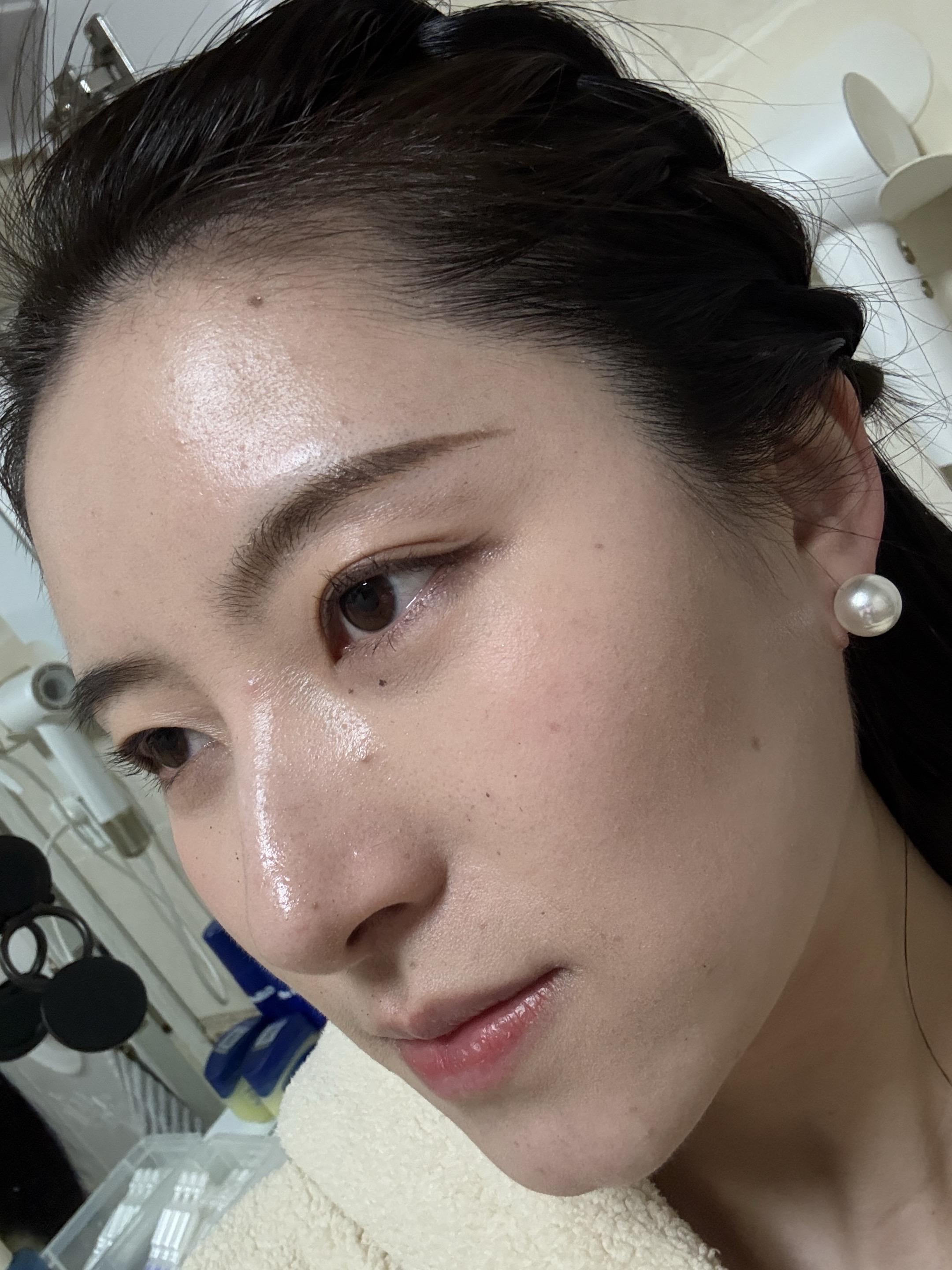 被烟花炸一脸的回忆