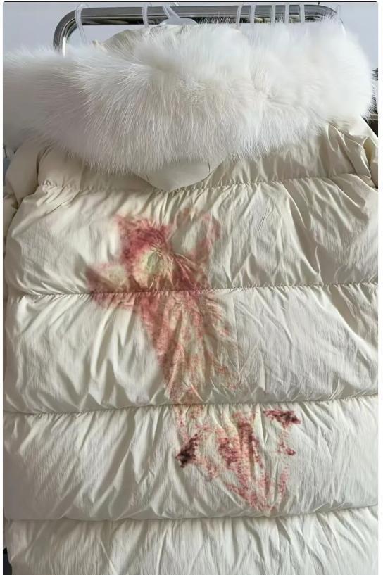 你用的肥皂、彩漂、白醋，正在把这个污渍焊死在羽绒服上。
那根本不是油渍或灰尘。