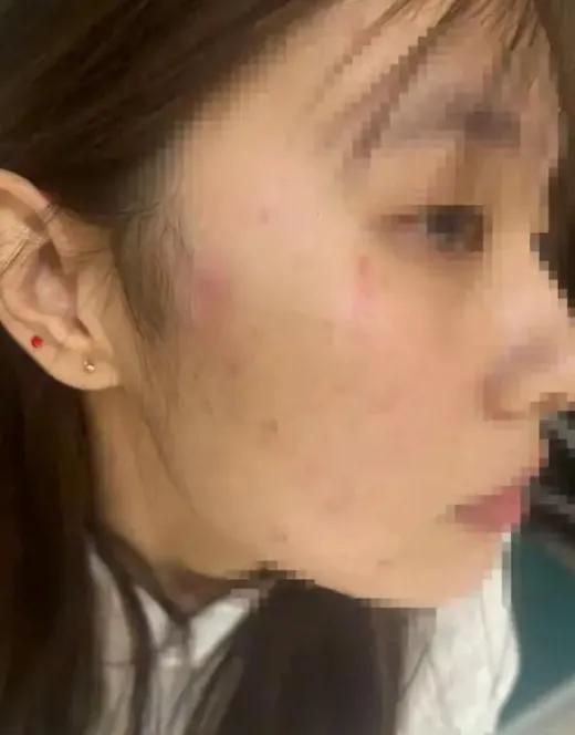 家里进了人打我，还手反倒成了互殴？

这事搁谁不憋屈！18岁女孩小莹独自在家，因