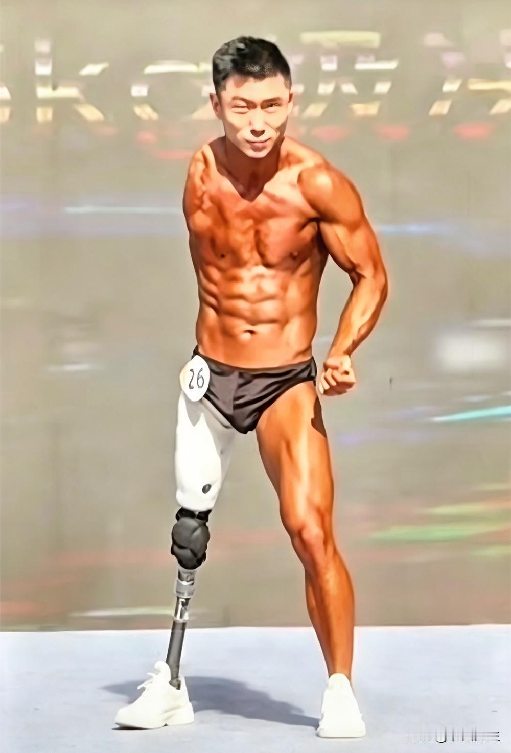 郭少宇，只有一条腿、一只胳膊，却硬生生练出一身炸裂肌肉，站上了健美比赛的舞台，人