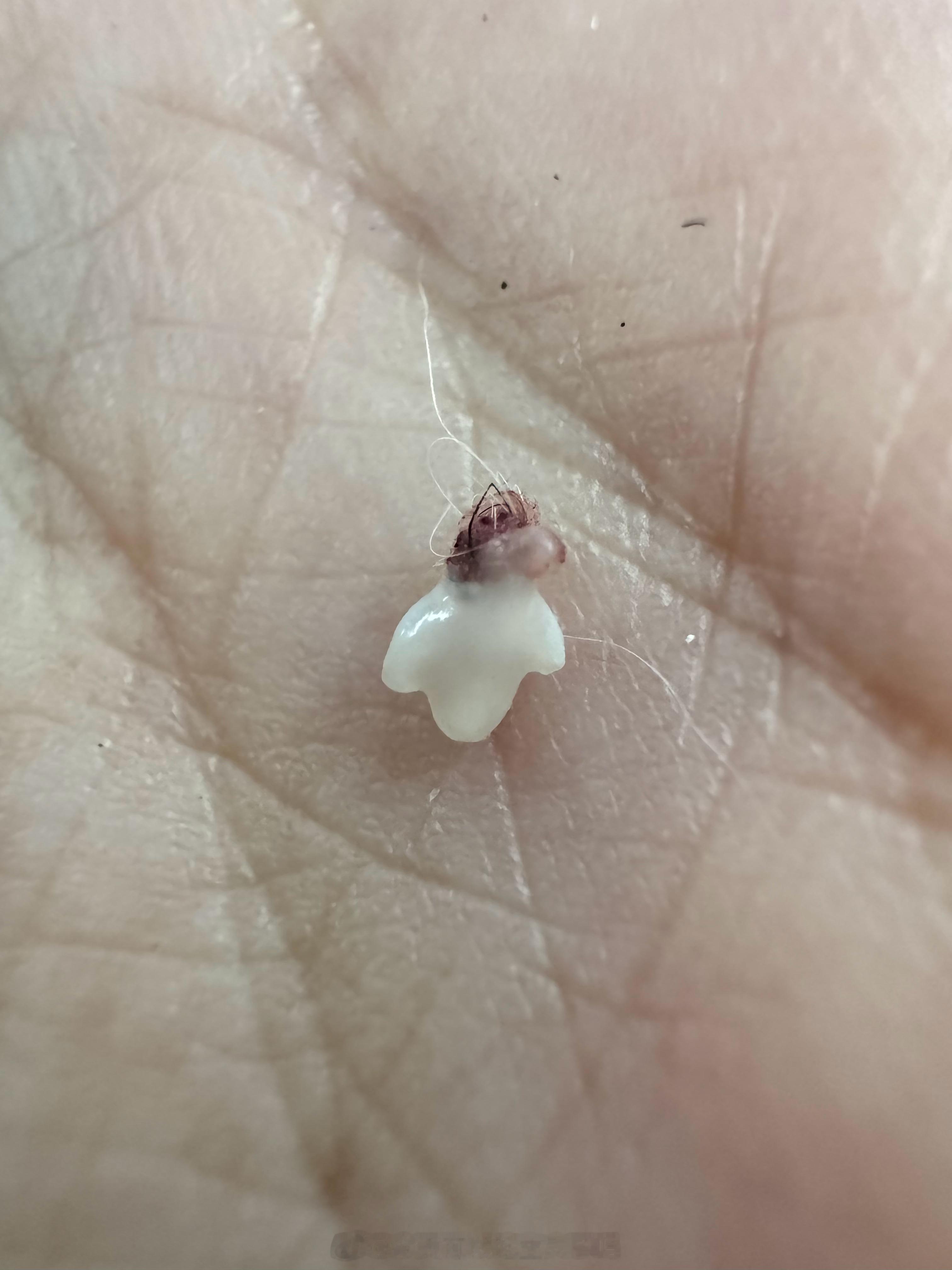 让我捡到了一颗狗的小门牙 