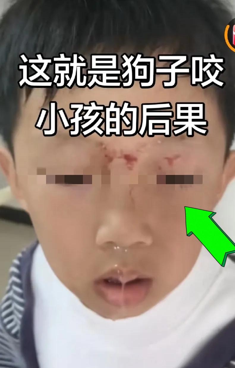 “至于打死吗，狗狗咬了孩子是犯了错，但是它也是一条生命啊”

起因是一条没拴绳的
