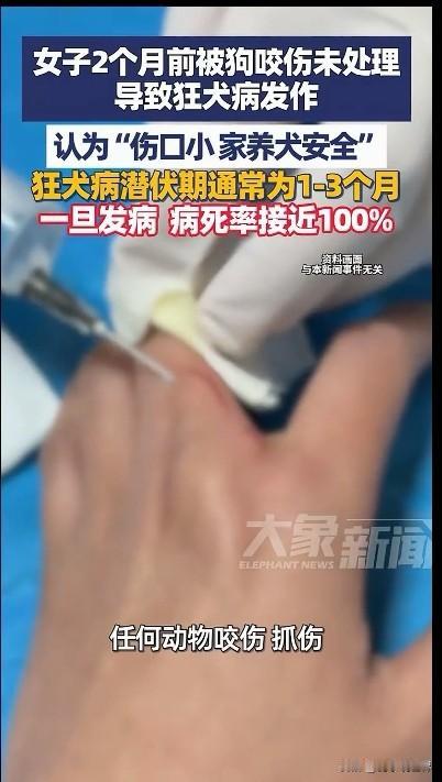 警惕！自家养的狗咬伤也应及时处理。
       29日，大象新闻报道，“长沙一
