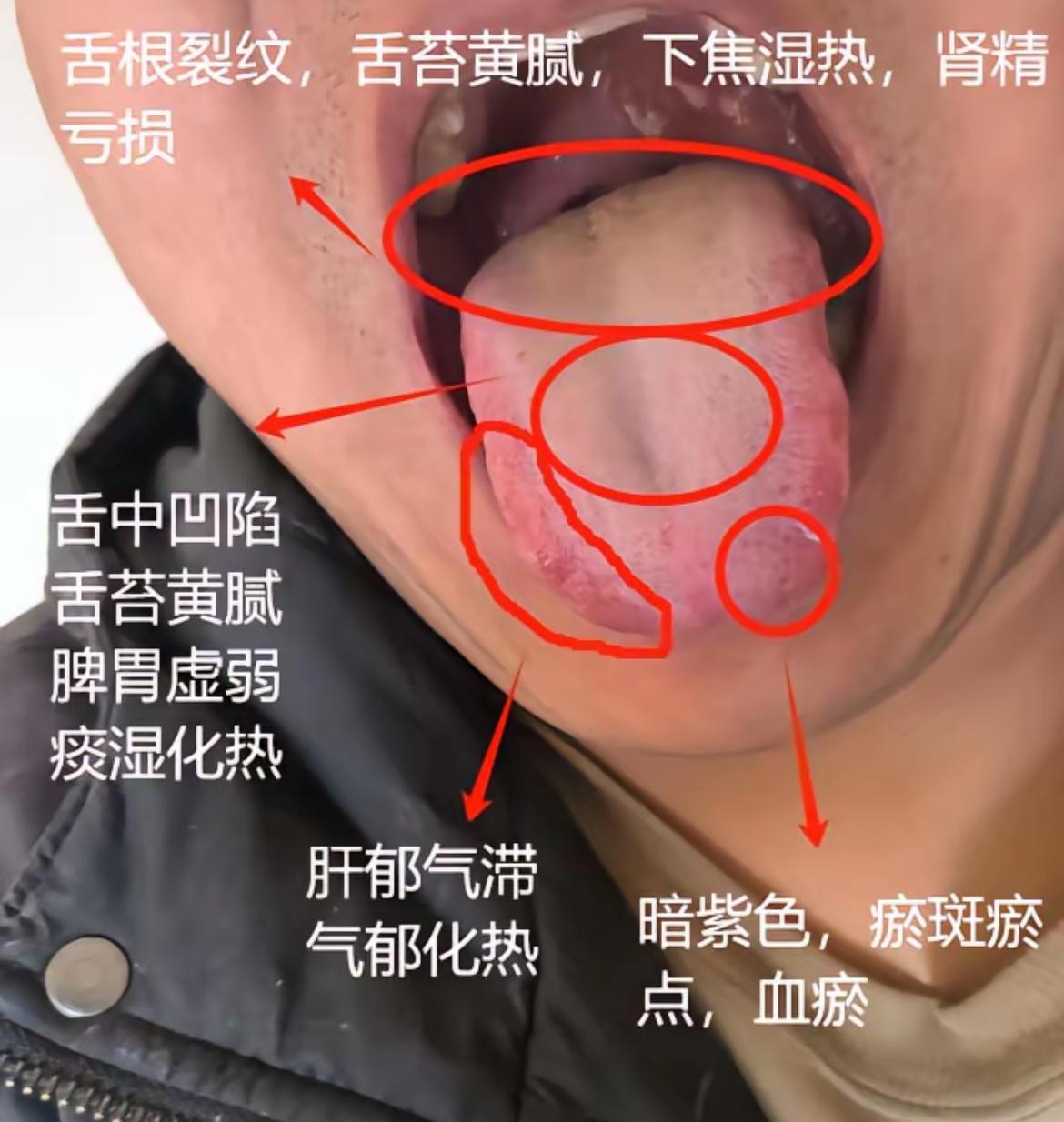 年龄不大31岁，心比天高，每天想那事，却不到两分钟
这位粉丝朋友留言说：麻烦潘医