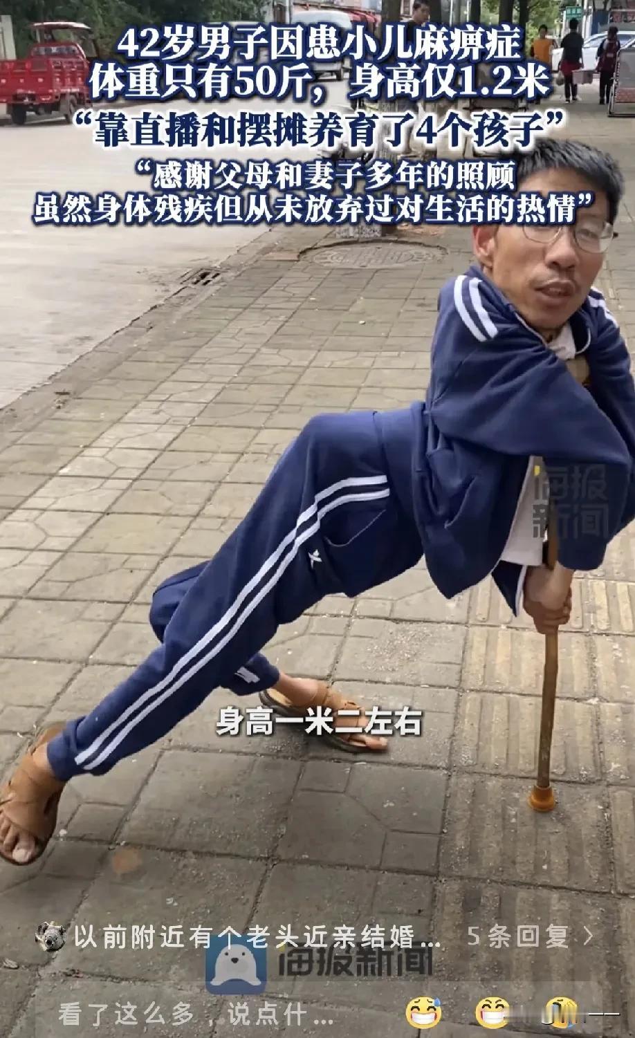 这个男子42岁，高1.2米，重50斤，因患小儿麻痹症，导致头部以下都是畸形的。