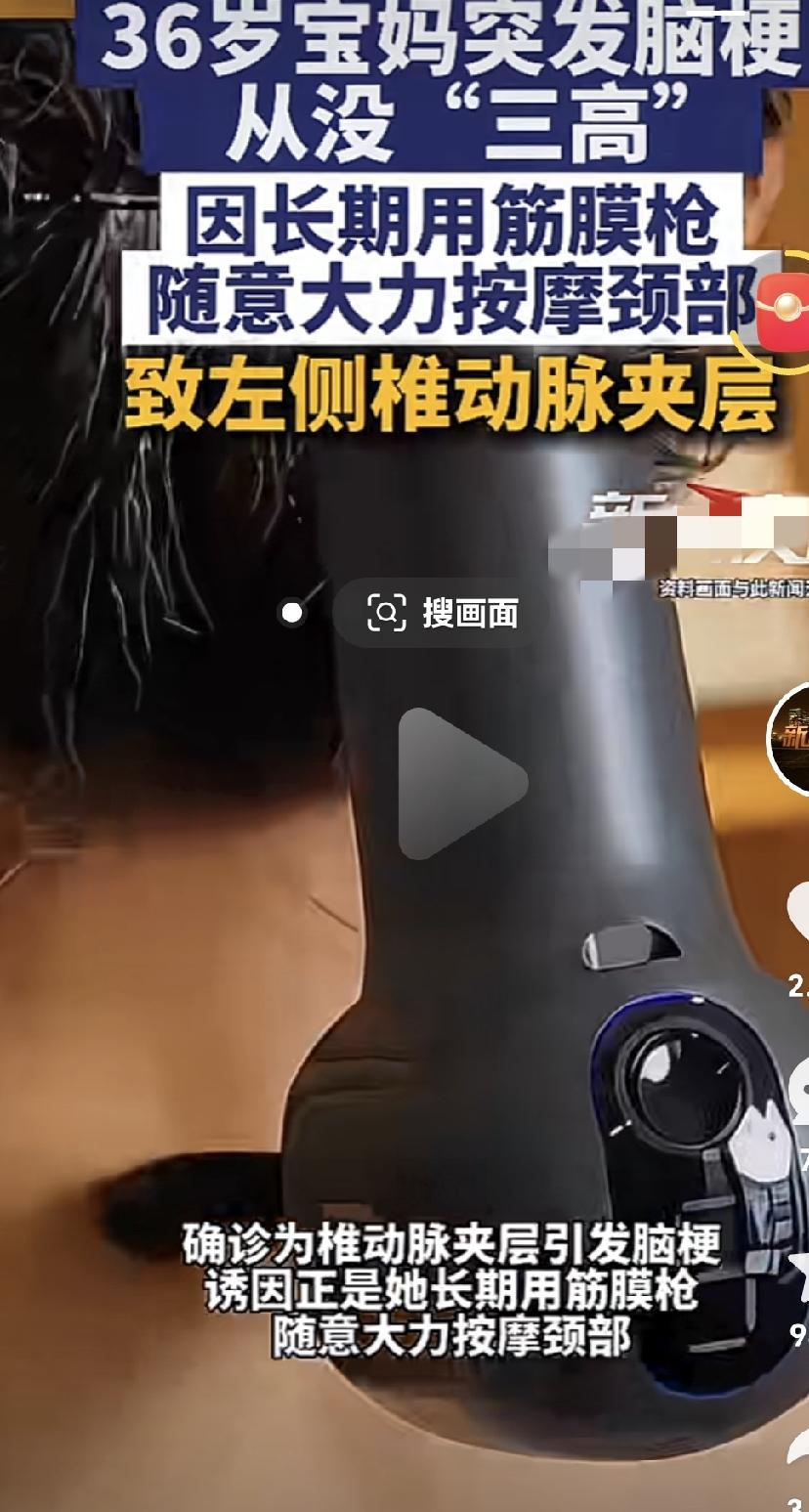 又是筋膜枪惹的祸，大家尽可能不买筋膜枪，不会用，真的会出现大问题！ 


一36