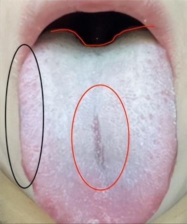 肝郁、脾虚、肾虚同时出现，到底先调理哪个呢？

患者主诉：功能下降，精神萎靡，胸