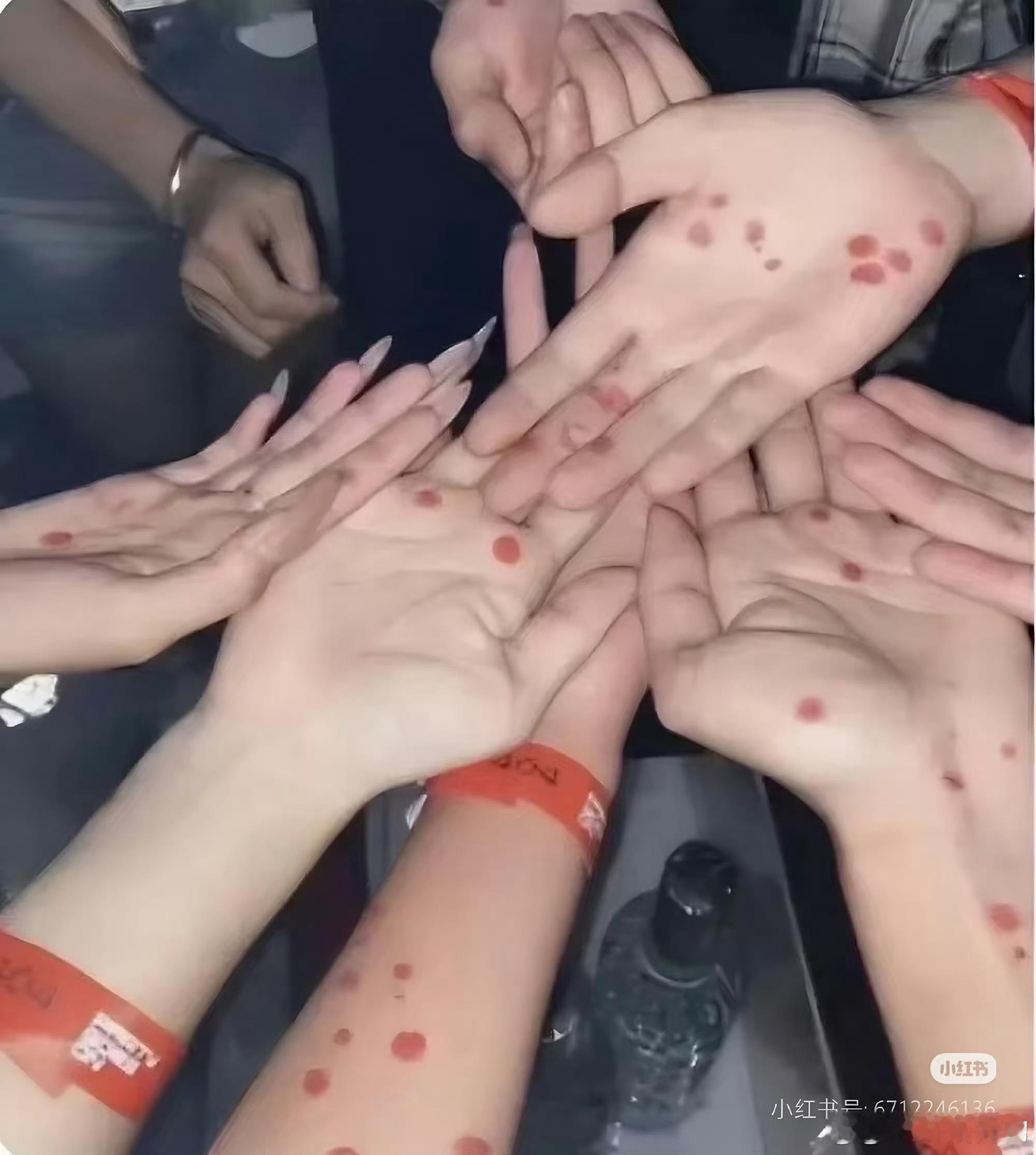 在日本没得病会画上梅毒妆跟风不是我不明白，这世界变化太快没有就画上，跟风梅毒妆世