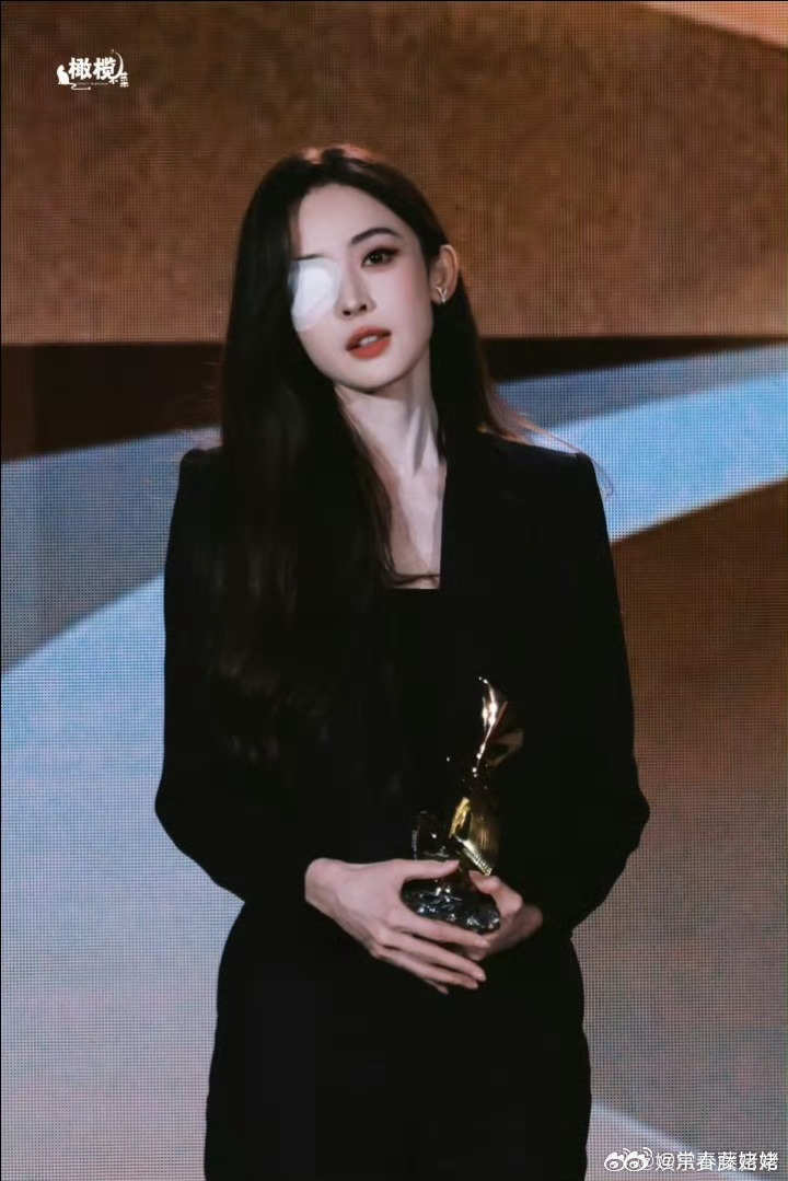 娜扎称眼睛恢复情况不太妙  天啊，女演员好拼，都这样了还出来工作，但是娜扎这样都