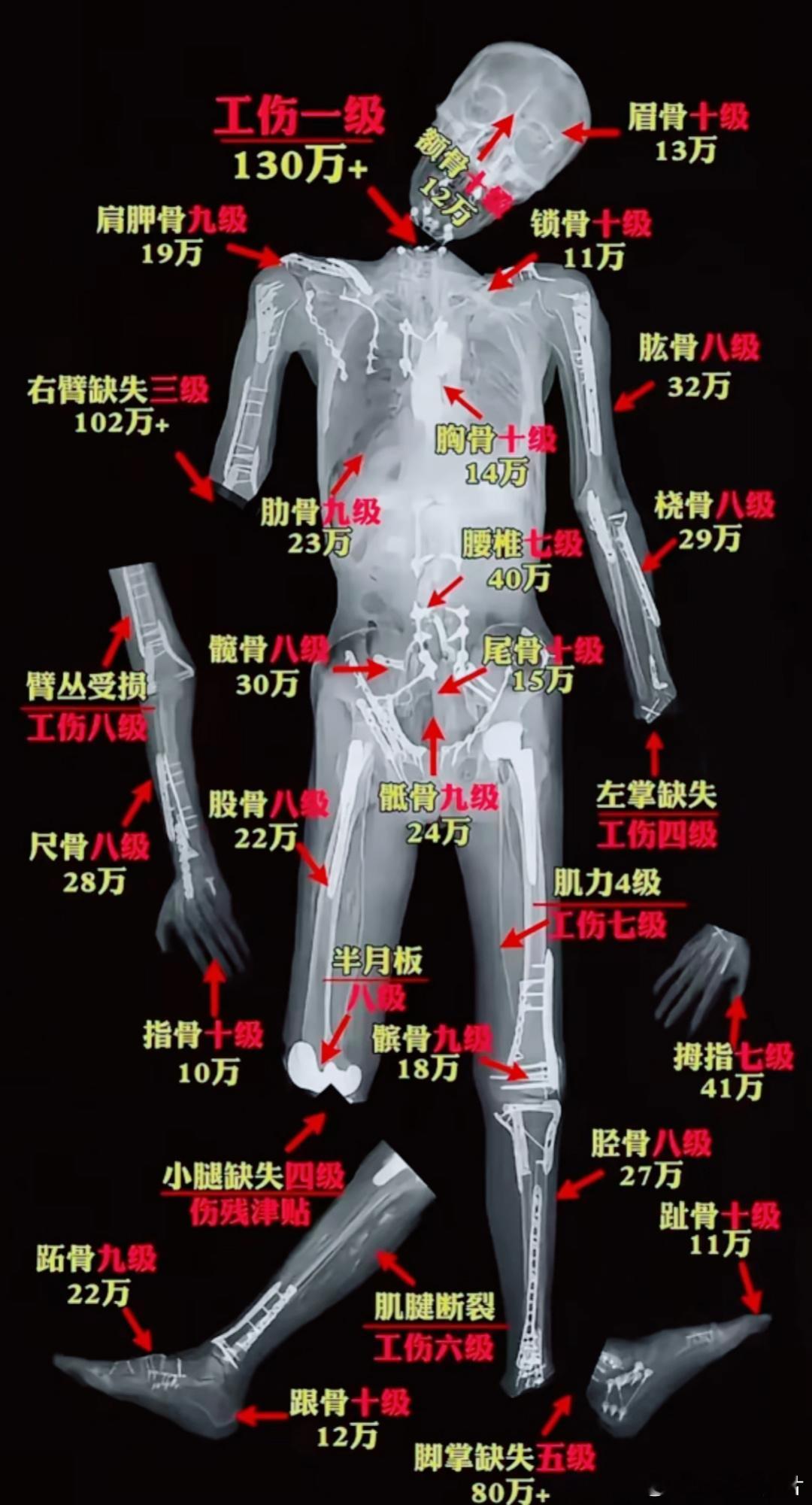 工伤不踩坑，工伤赔偿金的标准图示。