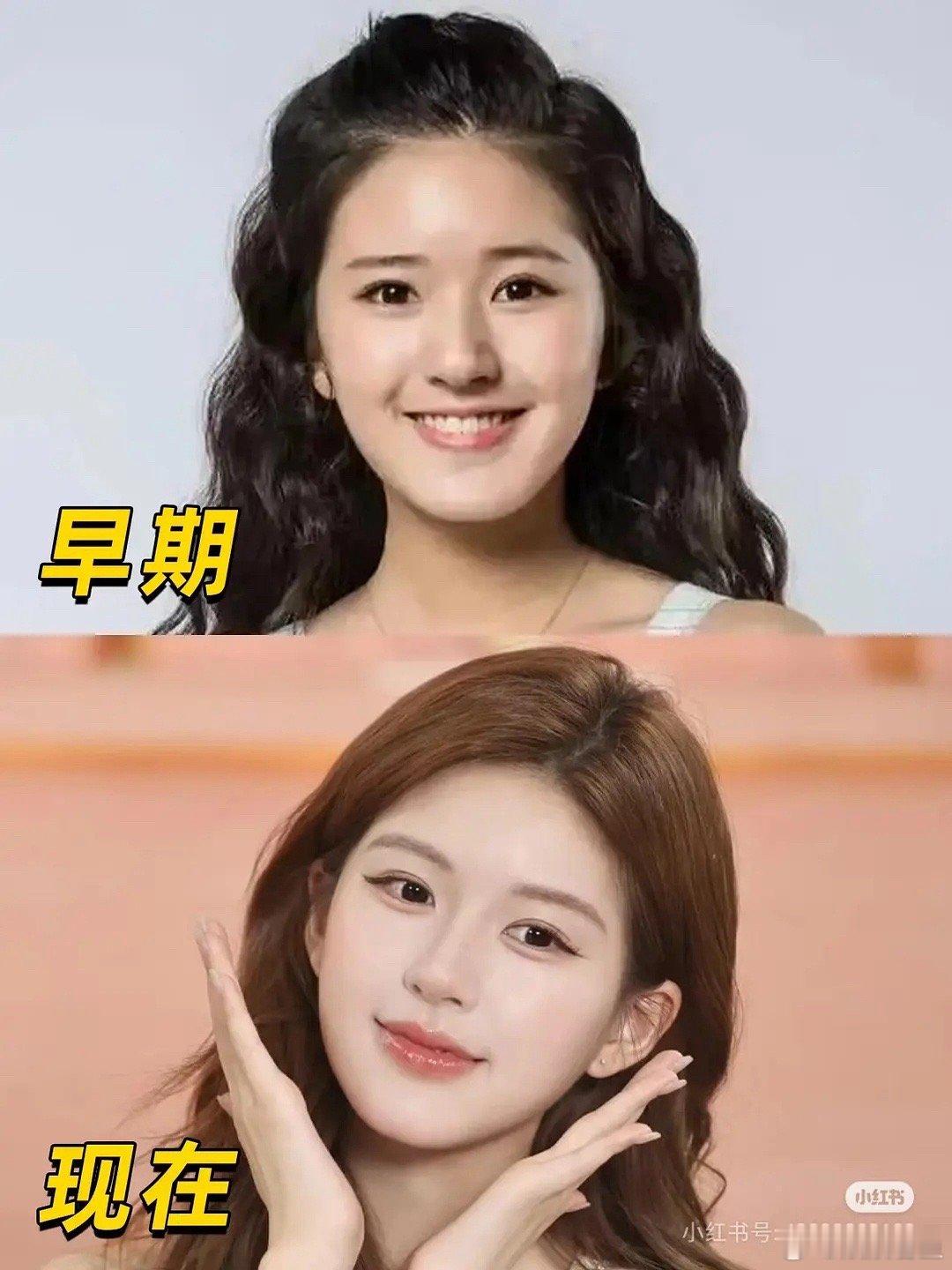 赵露思真的只是瘦了 ​​​